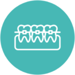 Orthodonticsbraces
